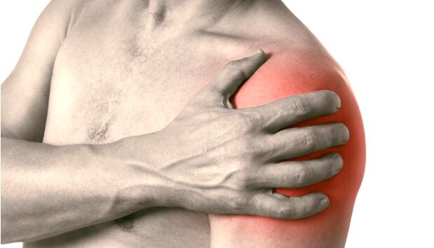 A swollen, red, enlarged shoulder - symptoms of osteoarthritis of the shoulder joint grade 2-3