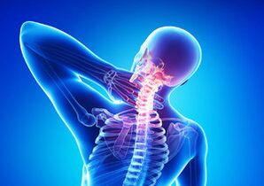 Signs of cervical osteochondosis