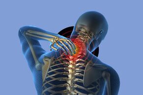 Symptoms of cervical osteochondosis