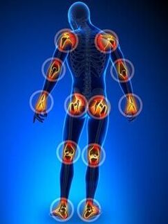 Location of joints affected by osteoarthritis