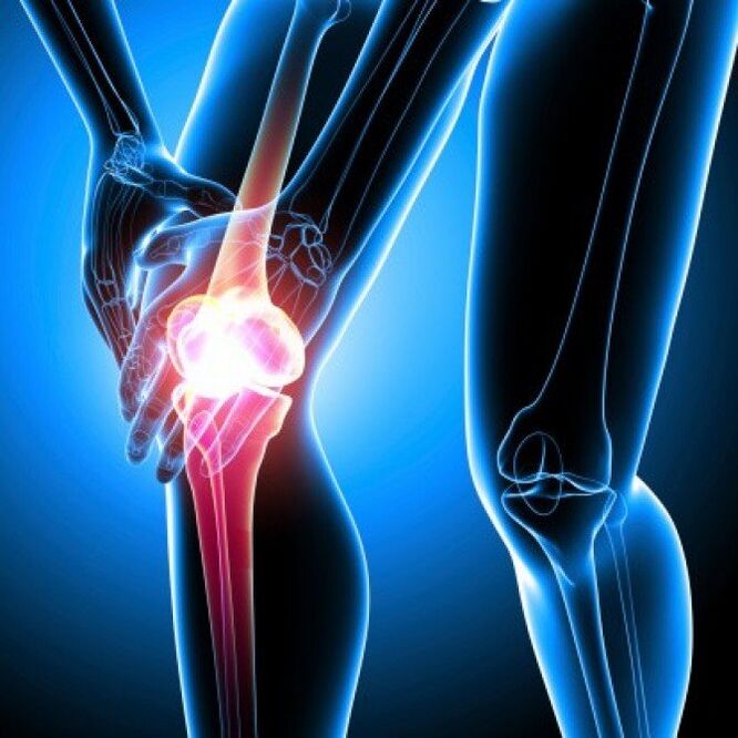 Advanced-stage rheumatoid arthritis can cause hip pain